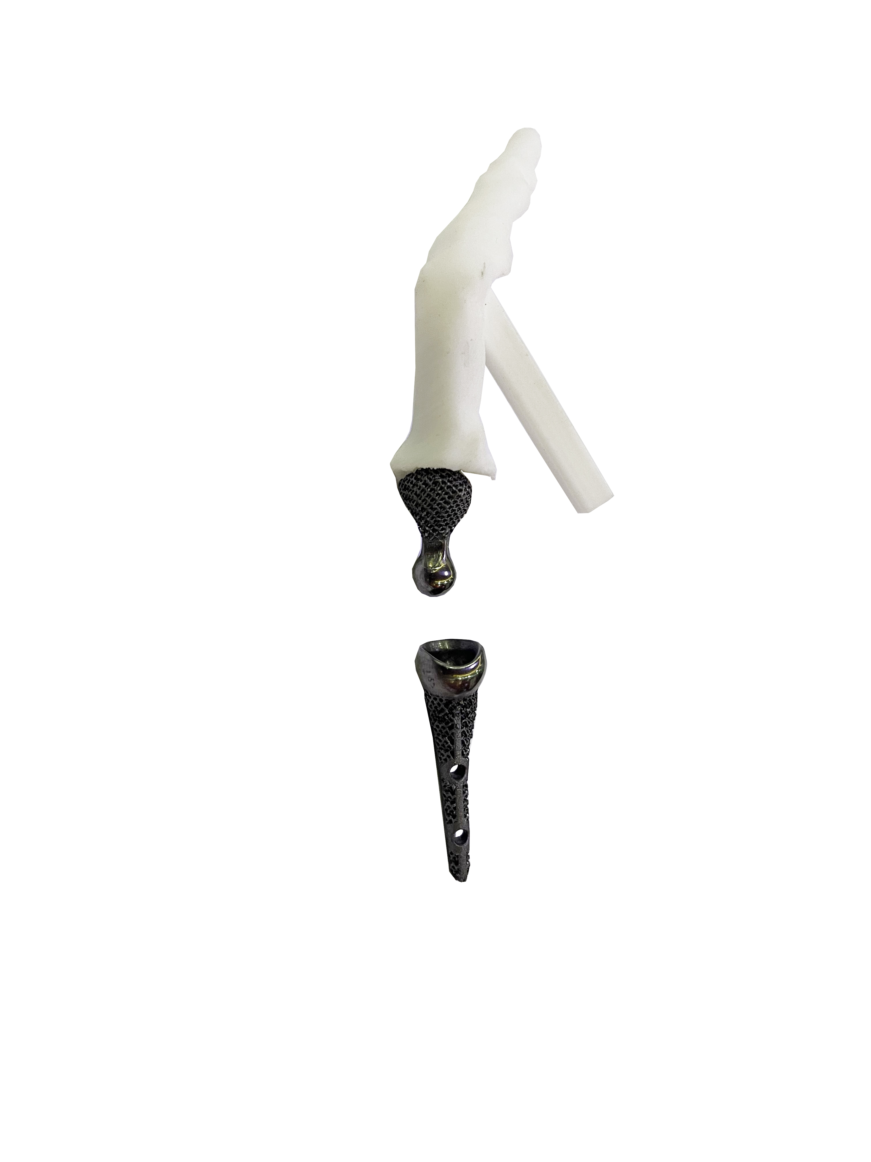 掌指 | 指间关节假体